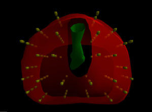 Read more about the article Αναβάθμιση Βραχυθεραπείας