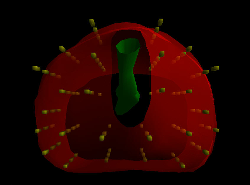 Read more about the article Αναβάθμιση Βραχυθεραπείας