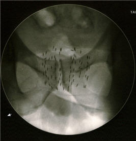 Read more about the article Κέντρο Βραχυθεραπείας