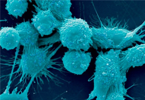 Read more about the article Προστάτης και τριχομονάδα